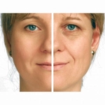 Gebelikte Açlık Kan Şekeri Kaç Olmalı? Gebelikte Açlık Kan Şekeri Kaç Olmalı?